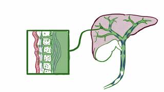 Primary sclerosing cholangitis causes symptoms diagnosis treatment amp pathology [upl. by Aguie596]