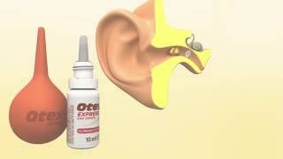 Candibiotic Ear Drop  Uses Dosage Side Effects Price Composition  Lybrate [upl. by Amandi185]