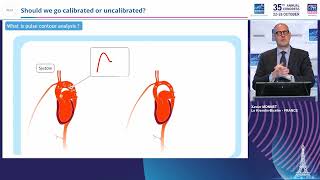 Xavier Monnet  Pulse contour analysis Should we go calibrated or uncalibrated [upl. by Lirret]