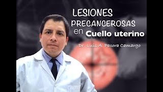 LESIONES EN CUELLO UTERINO POR QUE NO PAPANICOLAOU [upl. by Eanyl766]