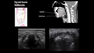 ENGNeck anatomy 1center [upl. by Yennor]