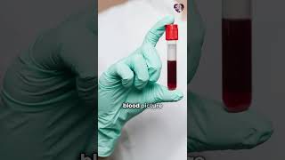 Unmasking Thalassemia A Guide to Testing amp Diagnosis  Dr Sheetal Dayal  thalassemia pregnancy [upl. by Genovera349]