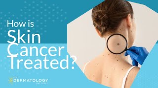 How is Skin Cancer Treated [upl. by Vassili]