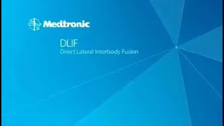 Medtronic Direct Lateral Interbody Fusion Animation [upl. by Eversole]