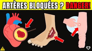 🛑Alerte Cardiaque 7 Signes dartères Bloquées Dans les Jambes et Les Pieds qui Mettent vie Danger [upl. by Guria]