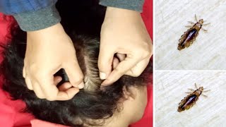 Lice Picking ASMR  Hair Care amp Treatment Sounds [upl. by Dusen]