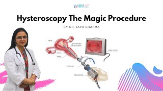 Hysteroscopy The Magic Procedure  DrJaya sharma  Senior IVF SpecialistNoble IVF [upl. by Neraa]