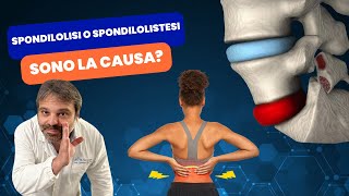 🔥Spondilolistesi e SpondilolisiCause e Cure per il Mal di Schiena [upl. by Coward]