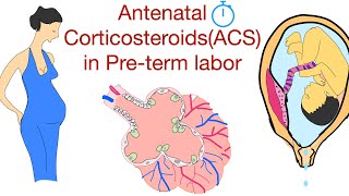 Antenatal corticosteroid use in preterm laborDexamethasone or Betamethasone injection in pregnancy [upl. by Nylrahc]