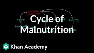 Cycle of Malnutrition [upl. by Eveiveneg547]