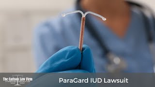 ParaGard Lawsuit  Copper IUD [upl. by Bonner]