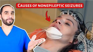 Causes of Nonepileptic Seizures PNES Hint NOT Stress [upl. by Wendolyn]