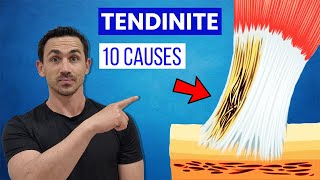 Quelles sont les 10 grandes causes des tendinites [upl. by Grey]