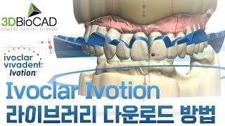 Ivoclar Ivotion 라이브러리 다운로드 방법 [upl. by Eanrahc]