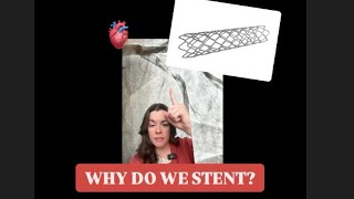 Why do we STENT if the CLOT is removed EXPLAINED [upl. by Medina]