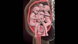 PRECIOUS MOMENTS OF TRIPLETS INSIDE THE WOMB 3D ANIMATION [upl. by Einalem851]