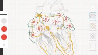 Cardiología y ECG Taquicardias supraventriculares vs ventriculares [upl. by Paulo956]