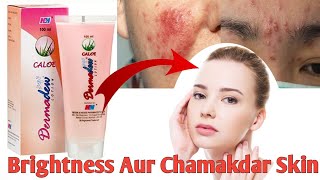 Dermadew Caloe Lotion hindi Review Iska Kam Kya Hai Side Effects Uses  benefits digitalmedilife [upl. by Maice]