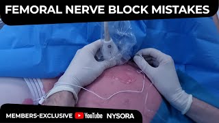 Femoral Nerve Block Common Mistakes  Crash course with Dr Hadzic [upl. by Lladnek]