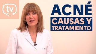 Causas y tratamiento del acné [upl. by Madelina428]