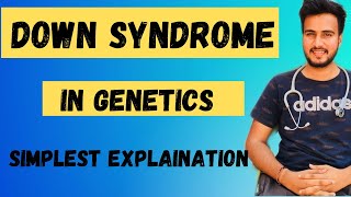 Down Syndrome in HindiDown syndrome causesSymptomsDiagnosisTreatment [upl. by Nnahs]