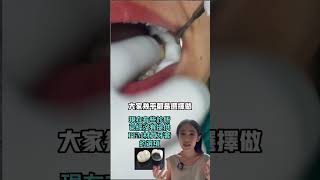 做假牙費用和房價一樣回不去了🥺顯微根管全瓷冠 [upl. by Viviana186]