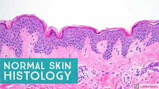 Normal Skin Histology  Explained by a Dermatopathologist [upl. by Whitson]