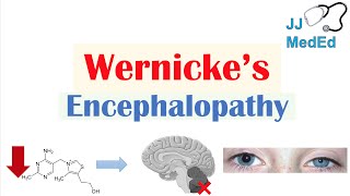 Wernicke’s Encephalopathy  Causes Symptom Triad amp Treatment [upl. by Bushweller]