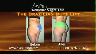 ManhattanSurgicalCarebrazilian buttlift [upl. by Jallier220]