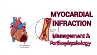 PATHOPHYSIOLOGY OF MYOCARDIAL INFRACTION [upl. by Orelle39]