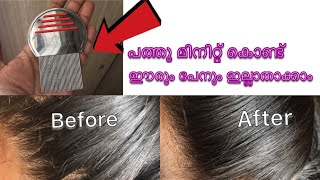 How to remove lice and nit easily  പത്തു മിനിറ്റ് കൊണ്ട് ഈരും പേനും ഇല്ലാതാക്കാംHow to remove lice [upl. by Walkling]