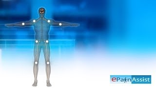 Fibromyalgia Explained Learn About 11 Tender Points Symptoms Causes of Fibromyalgia [upl. by Evans]