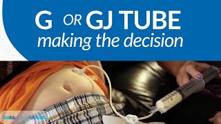 The GGJ Tube Decision  AboutKidsHealth at The Hospital for Sick Children [upl. by Rossie413]