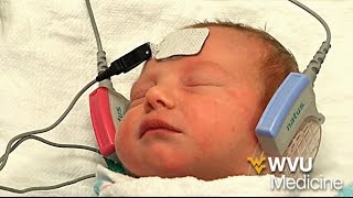 Newborn Hearing Testing  WVU Medicine Health Report [upl. by Nickolaus624]