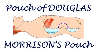 Chp18  Special Regions of Peritoneal Cavity  Pouch of Douglas  HepatoRenal Pouch  BDC Vol2 [upl. by Bonner]