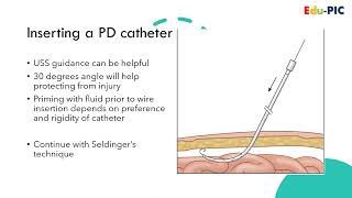 Renal Replacement Therapy Peritoneal Dialysis [upl. by Ednalrim]