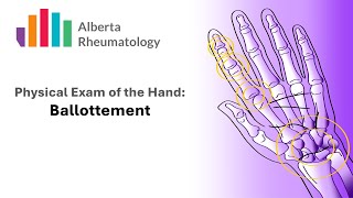 Rheumatology HAND exam Palpation for Joint Swelling [upl. by Magree]