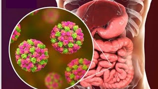 5 señales de que podría tener gastroenteritis virales [upl. by Rust]