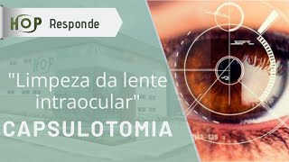 Capsulotomia quotlimpeza da lente intraocularquot [upl. by Herates]