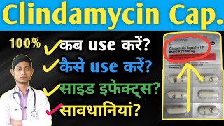 Clindamycin capsule 300 mg  Acne pimplesमुहासो की बेस्ट दवा  Clinfamycin  Dalacin c 300mg [upl. by Laemaj302]