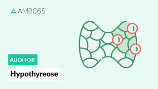 Hypothyreose  Interpretation der Laborwerte  AMBOSS Auditor [upl. by Hahn]