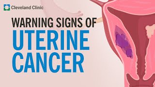 The Most Common Warning Sign of Uterine Cancer [upl. by Oloapnaig]