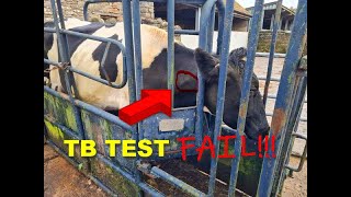 TB TEST FAIL [upl. by Leamsi]