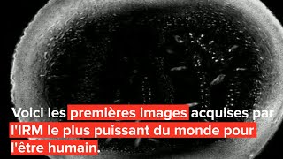 Première mondiale L’IRM le plus puissant au monde livre ses premières images [upl. by Rachele946]