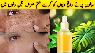 How to remove dark spot in 3 days  How to get rid dark spots with home remedy  skin care [upl. by Shivers322]