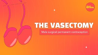 Vasectomy FAQs 🧐❓ [upl. by Suriaj704]