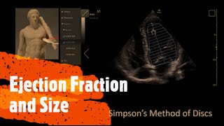 Measure Ejection Fraction EF and Ventricle Size Perioperative amp Critical Care ECHO  POCUS [upl. by Lilly]