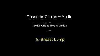 5 Breast Lump  SURGERY AUDIO Case presentation for Final MBBS by Ghanashyam Vaidya [upl. by Dann]