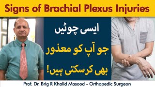 What Brachial Plexus Injury  Brachial Plexus Injury Ka Ilaj Kya Hai [upl. by Alek]