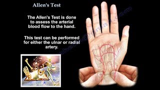 Allens Test circulation of the hand  Everything You Need To Know  Dr Nabil Ebraheim [upl. by Padgett]